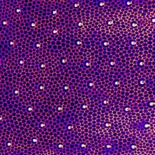 Dorsal epithelium of a drosophila pupae during metamorphosis marked with a E-cadherine reporter.