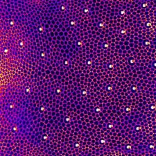 Crédit : Aude-Maugarny-Cales, Bellaiche lab Dorsal epithelium of a drosophila pupae during metamorphosis marked with a E-cadherine reporter.