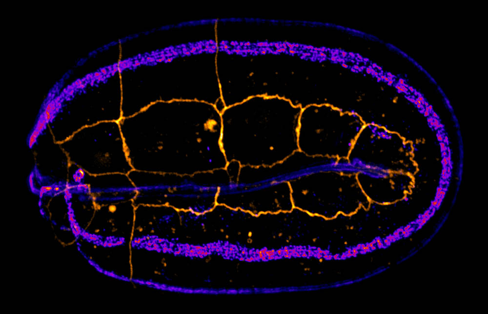 Embryon de C. elegans
