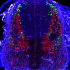 Crédit : Melanie Roussat, Pituello lab Coupe transversale de tube neural murin à E11.5. Immunomarquage Pax2 en rouge (neurones dorsaux inhibiteurs), Tlx3 en vert (neurones dorsaux excitateur), Pax7 en bleu (progéniteurs dorsaux).