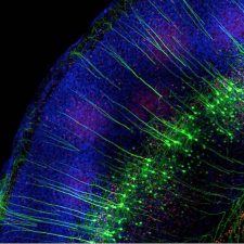 Crédit : Studer lab Mouse brain