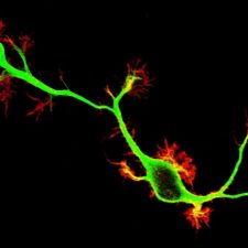 Crédit : Studer lab Primary mouse neurons