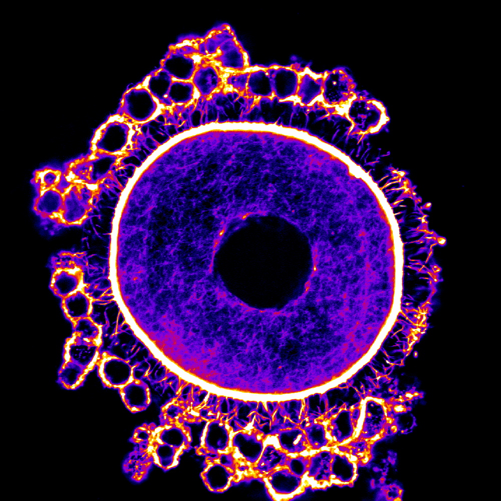 Crédit : Flora Crozet, Terret & Verlhac lab Actine dans un ovocyte de souris